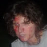 brandgrenade